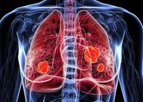 Population Science Program